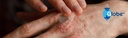 globe-hydrocortisone-1-maximum-strength--4.jpg