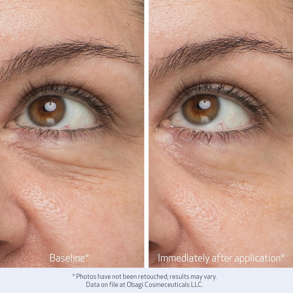 obagi-daily-hydro-drops-rejuvenating-eye-4.jpg