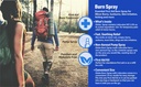 globe-burn-spray-lidocaine-2-topical-ane-5.jpg