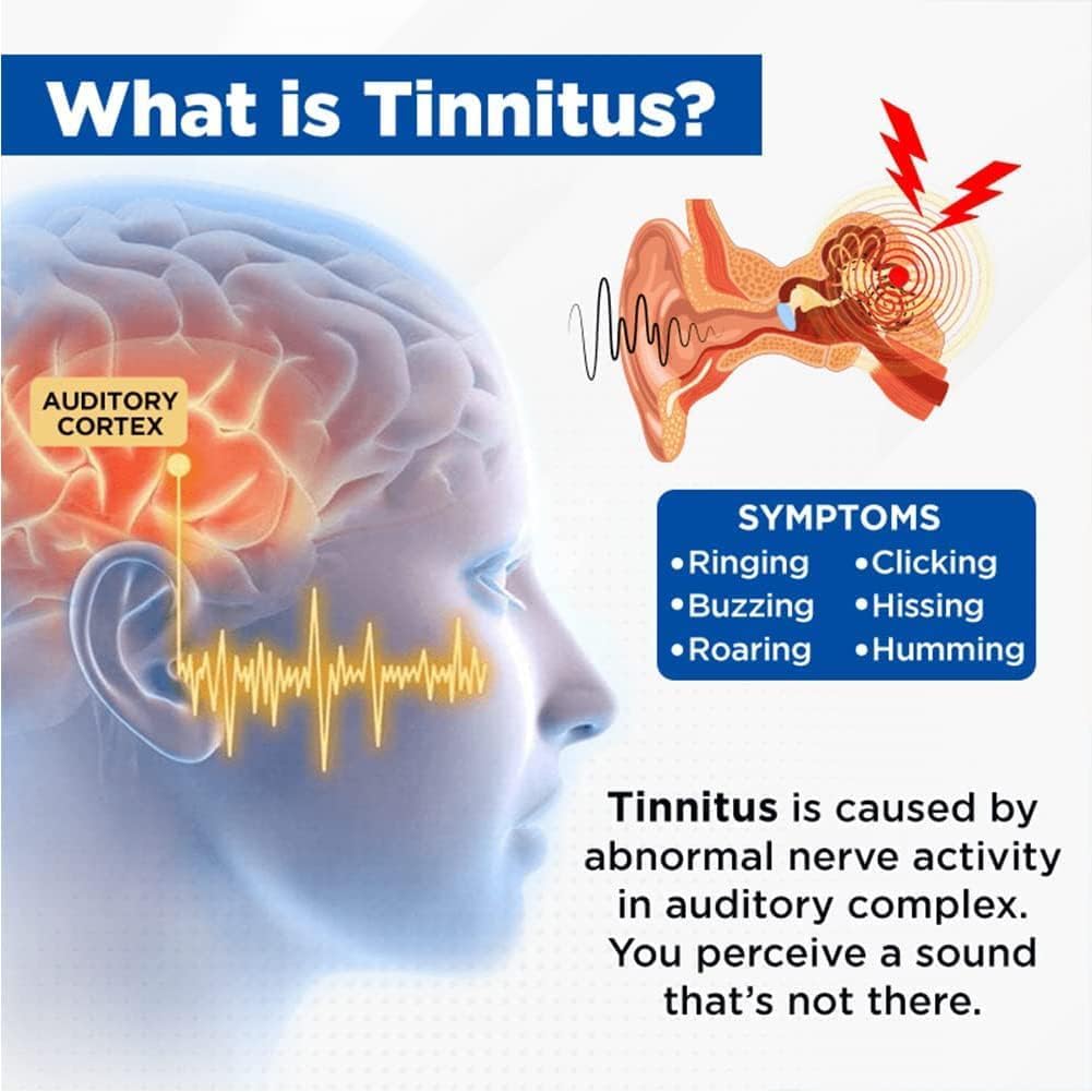 acupeace-tinnitus-relief-device-acupeace-2.jpg