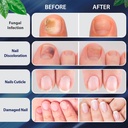 tobcharm-toenail-fungus-treatment-extra--4.jpg