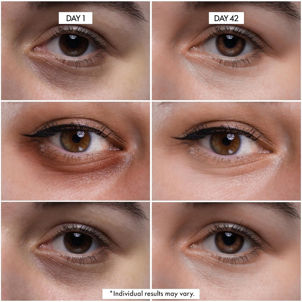 eye-cpr-advanced-repairing-treatment-for-2.jpg