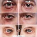 eye-cpr-advanced-repairing-treatment-for-3.jpg