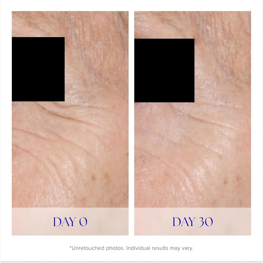is-clinical-youth-eye-complex-anti-aging-4.jpg