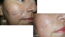 for-treatment-of-scars---30g---psoriasis-2.jpg