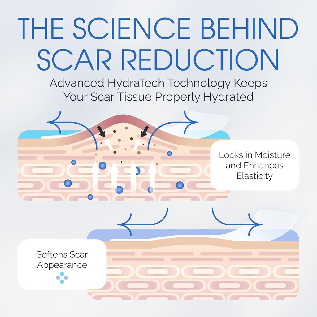 medical-grade-silicone-scar-sheets---7-r-6.jpg