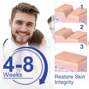 new-transparent-silicone-scar-sheets16-x-6.jpg