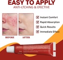 hydrocortisone-cream---otc-anti-itch-rel-3.jpg