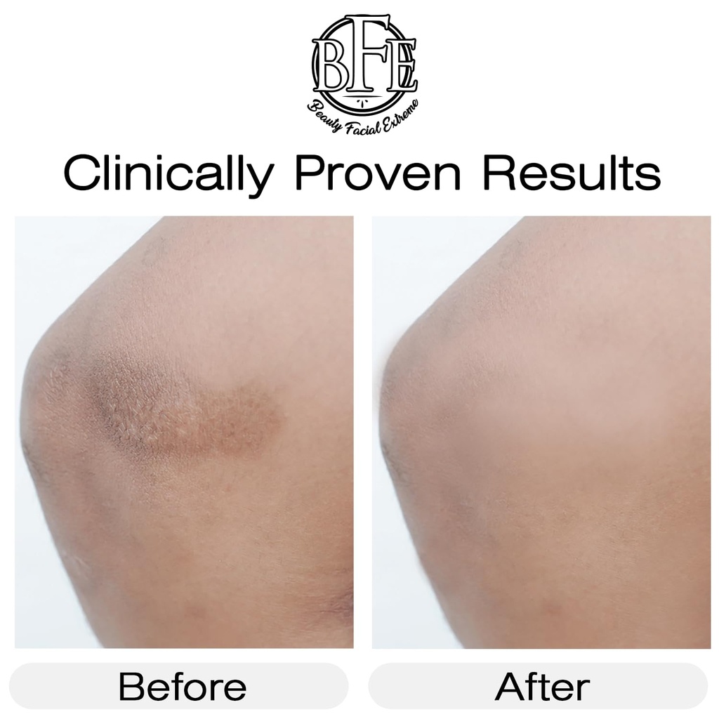 vitamin-k-cream--moisturizing-bruise-hea-3.jpg