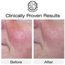 vitamin-k-cream--moisturizing-bruise-hea-5.jpg