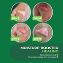 turfguard-hydrogel-turf-burn-dressing-wi-6.jpg
