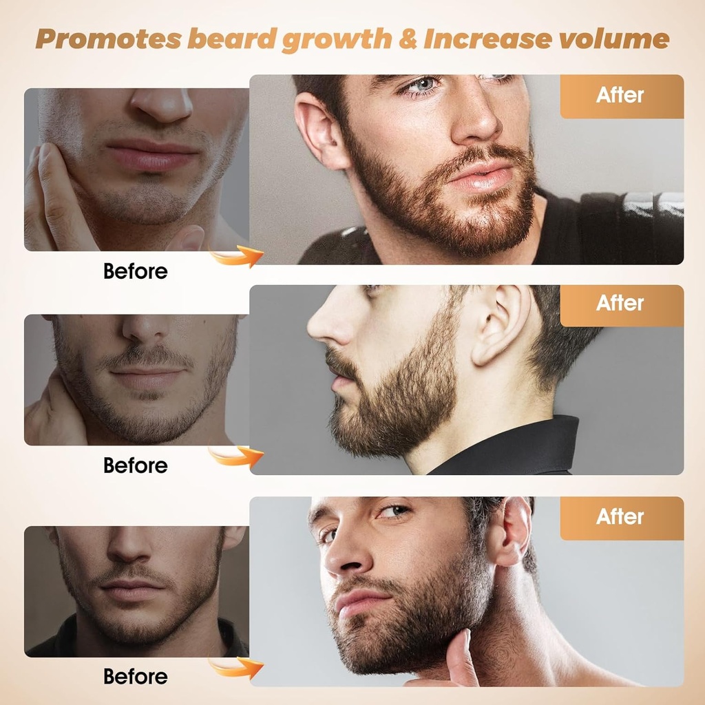 beard-oil---natural-care-facial-beard-oi-3.jpg