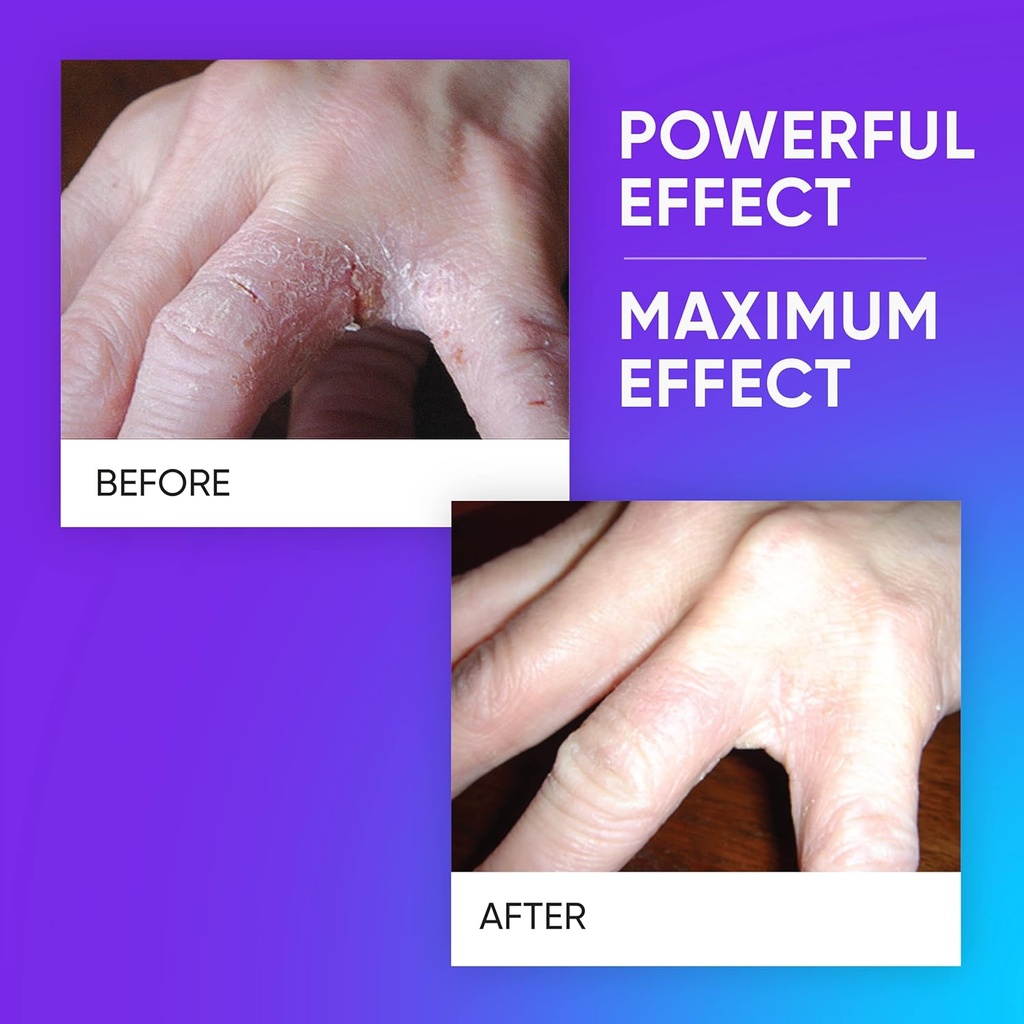 ultra-patented-anti-itch-cream-with-dhea-5.jpg