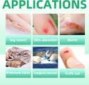 dr-med-calcium-alginate-wound-dressing-4-5.jpg