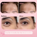 jjgs-forehead-under-eye-patches-bundle-d-6.jpg
