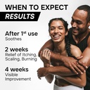 antifungal-cream-for-athletes-foot-ringw-3.jpg