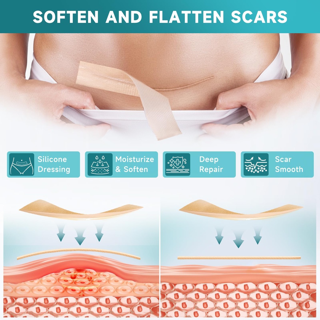 pumkot-silicone-scar-sheets-silicone-sca-4.jpg