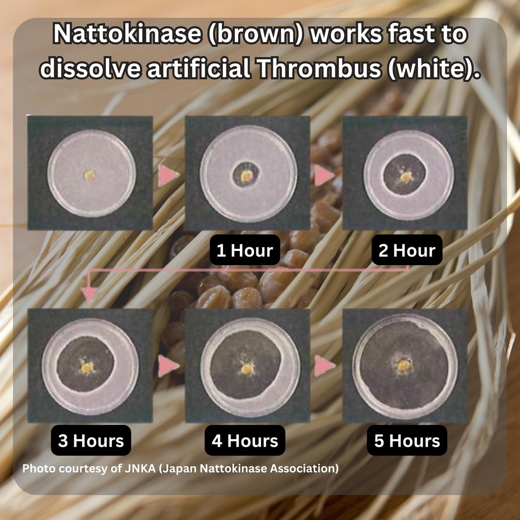 nattokinase-2-000-fu-and-kefir-supplemen-4.jpg