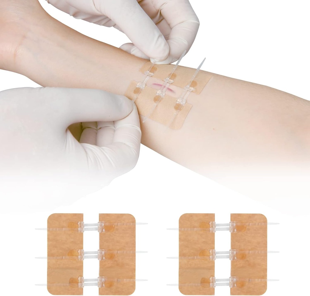 Zip Stitch Laceration Repair Without Stitches Butterfly Bandaids Quick Clot - Emergency Wound Closures Device 2 Pieces（PU）